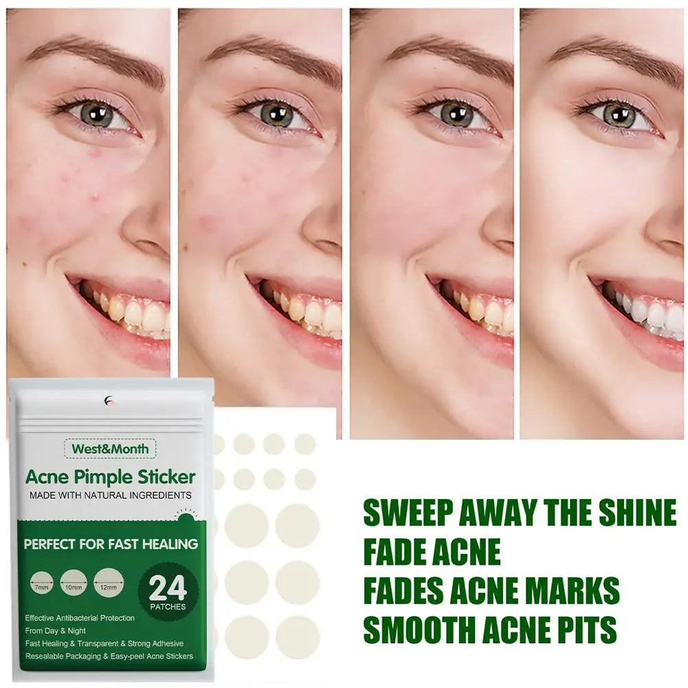 Acne Pimple Sticker